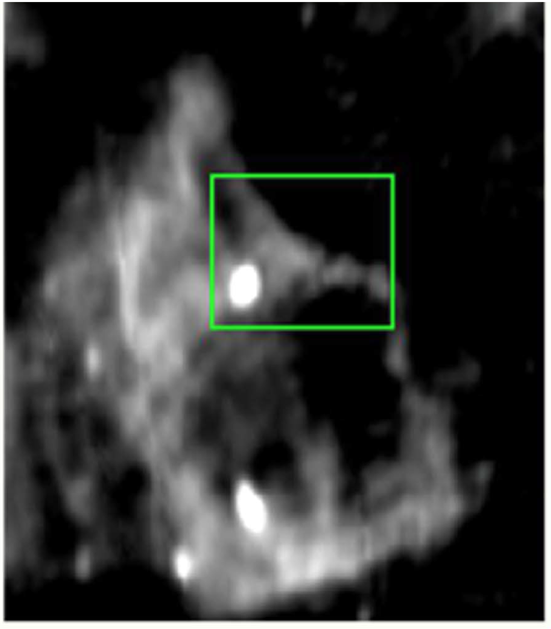 Radio telescope image of supernova remnant G357.7+0.3